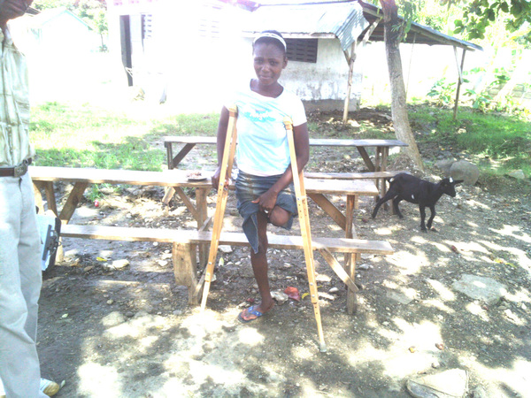 One of the many amputees in Haiti.
